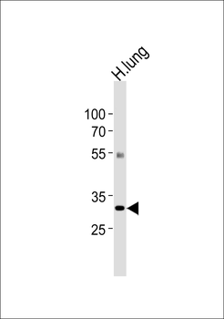 CSF2RA Antibody(C-term)