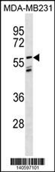 LGI3 Antibody(Center)