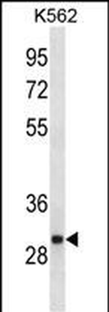 VAPA Antibody(C-term)