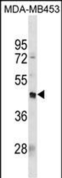 PDCD2L Antibody(Center)