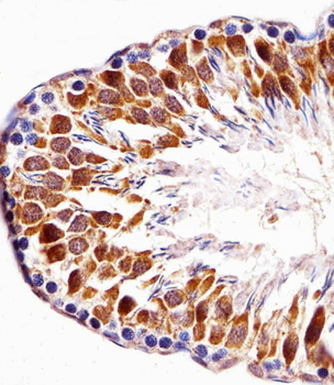 Pbk Antibody (N-term)