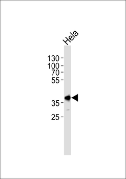 Pbk Antibody (N-term)