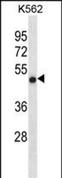 CCDC6 Antibody(N-term)