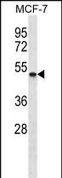 SMYD5 Antibody(C-term)