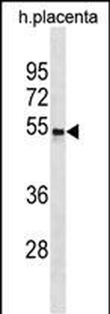 CCKAR Antibody(Center)