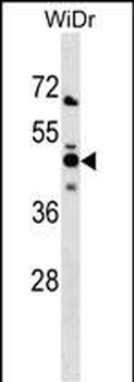 NMI Antibody (N-term)