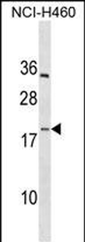 PF4V1 Antibody (C-term)