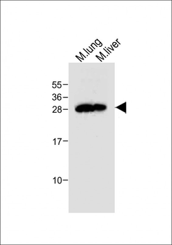 Mouse Trem2 Antibody (N-term)