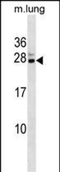 Mouse Cbx5 Antibody (C-term)