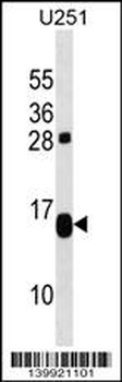 TP53TG1 Antibody (N-term)