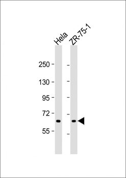 TGM5 Antibody (C-term)
