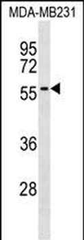 AKAP5 Antibody (Center)