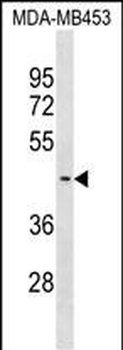 SUV39H2 Antibody (C-term)