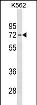 IL22RA1 Antibody (C-term)