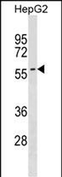 SMPD3 Antibody (N-term)