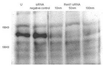 RENT1 Antibody (Center)