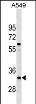 XRCC4 Antibody (Center)