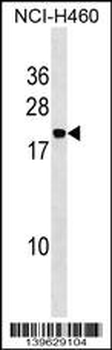 PPIAL4A Antibody (Center)