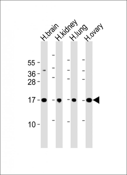 PPIAL4A Antibody (Center)