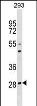 OSCAR Antibody (C-term)