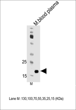 Mouse Apom Antibody (Center)