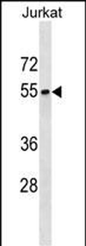 SEPT6 Antibody (C-term)