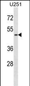 ARMCX3 Antibody (C-term)