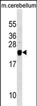 TAGLN3 Antibody (N-term)