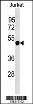 NXF5 Antibody (N-term)