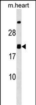 MED9 Antibody (C-term)
