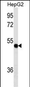 TXNDC5 Antibody (Center)