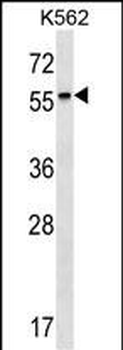 RARB Antibody (Center)