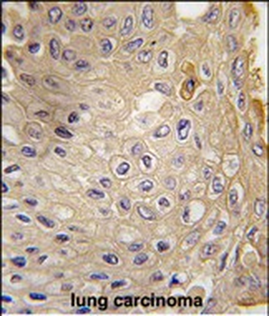 ATG9A Antibody