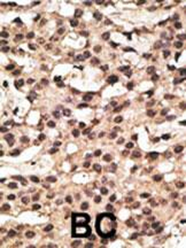ATG9A Antibody (Center)