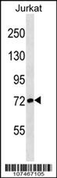 ATG7 Antibody (N-term)
