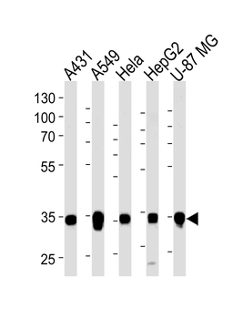 MDH2 Antibody (C-term)