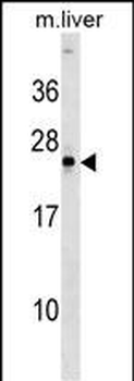 NOG Antibody (Center)