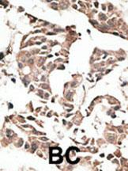 ATG4C Antibody (N-term)