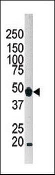 ATG4B Antibody (C-term)