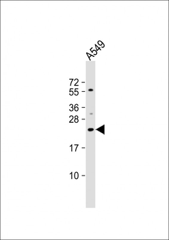 ECSCR Antibody (C-term)