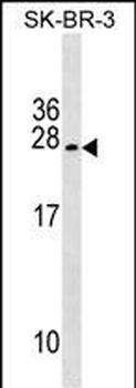 TUSC5 Antibody (Center)