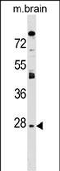 AQP1 Antibody (C-term)