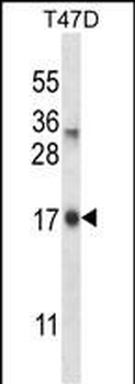 IGF2AS Antibody (Center)