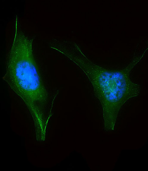 LZIC Antibody (Center)