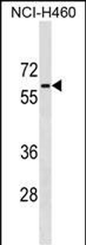 PGM5 Antibody (C-term)