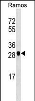 NOSIP Antibody (N-term)