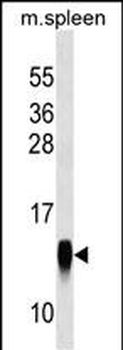 CRB3 Antibody (Center)