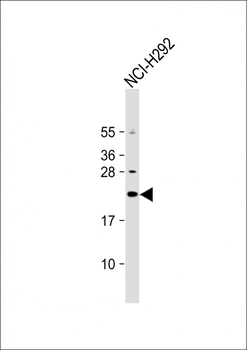 DNAJC5G Antibody (Center)