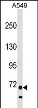ITK Antibody (N-term)