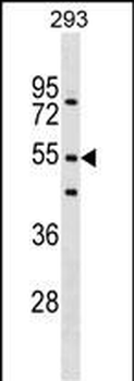 FBXW9 Antibody (N-term)